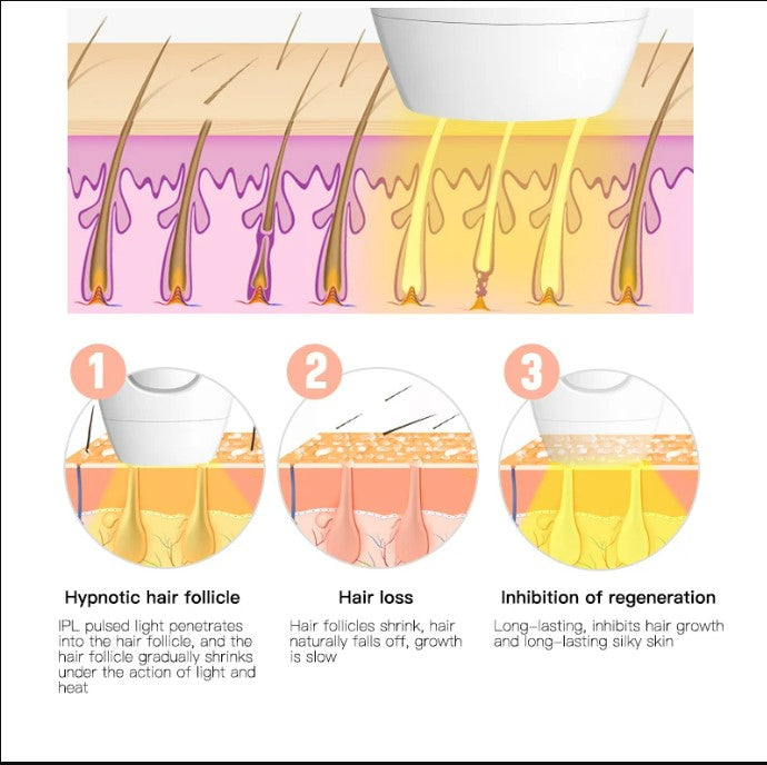 IPL Laser Hair Removal - White